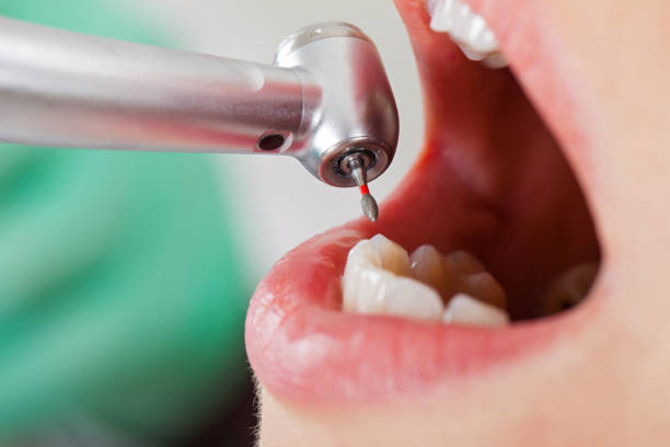 Best Emergency Dental Care for Broken or Chipped Teeth in West Grove, PA